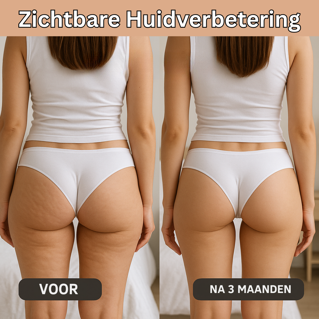 NOVA| Innovatieve 3D Anti-Cellulitis Legging