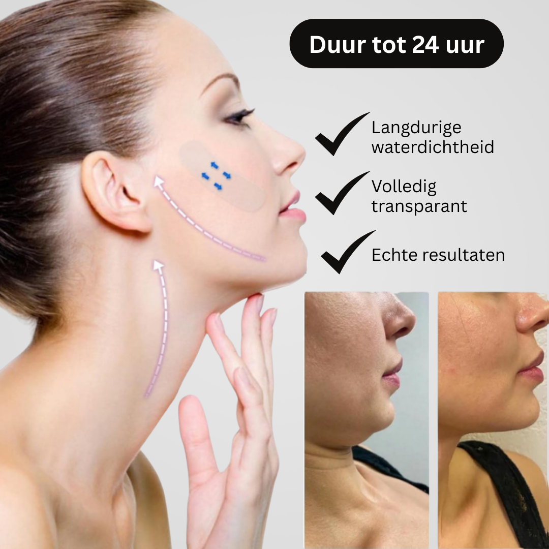 Marga Lifting Strips 2+2