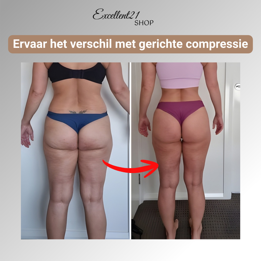 NOVA | 3D Compressie Legging voor Lipoedeem Comfort