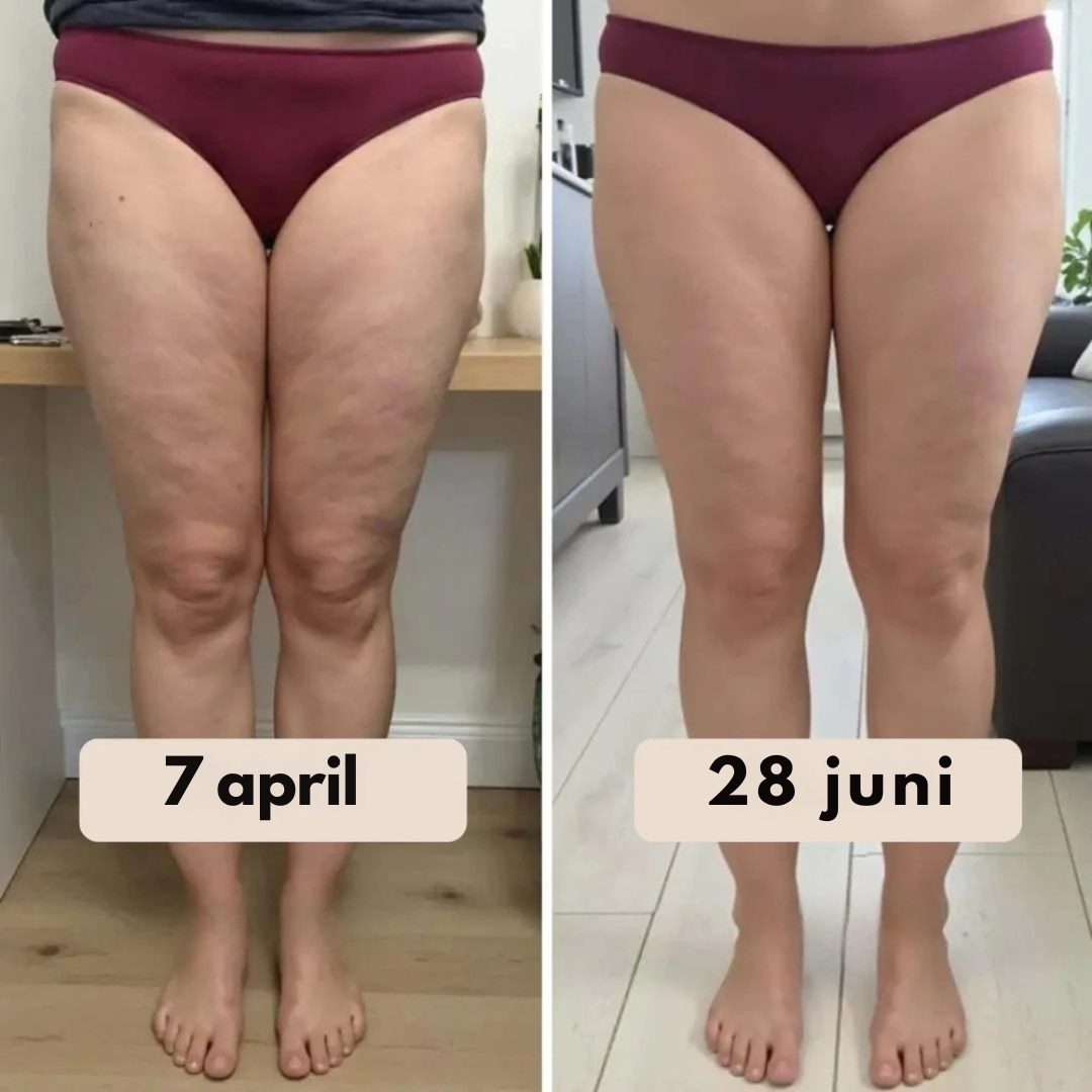 NOVA| Innovatieve 3D Anti-Cellulitis Legging