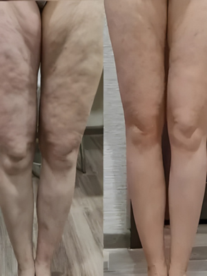 Zie de transformatie