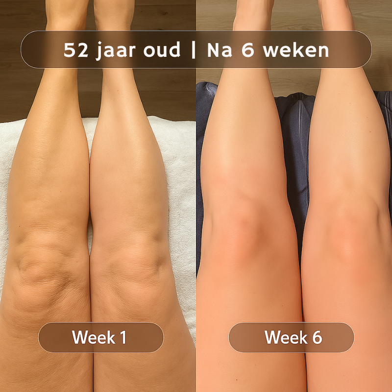 Flowziax Anti Cellulite Massage Olie