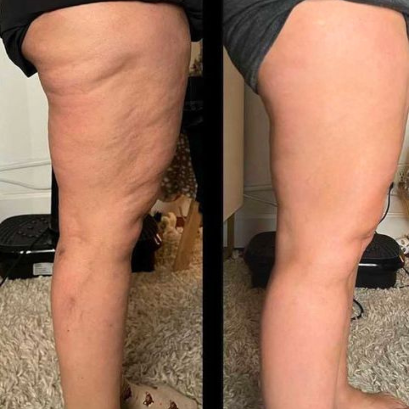 Oce Aura Anti-cellulitis Crème