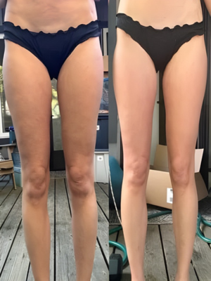 Zie de transformatie