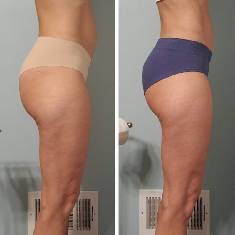 Flowziax Anti Cellulite Massage Olie