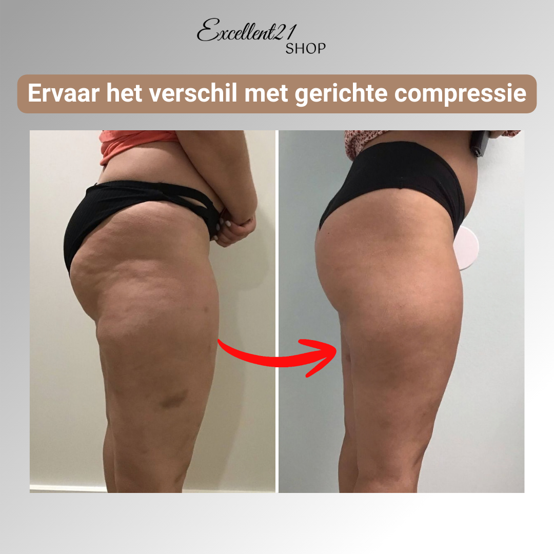 NOVA | 3D Compressie Legging voor Lipoedeem Comfort
