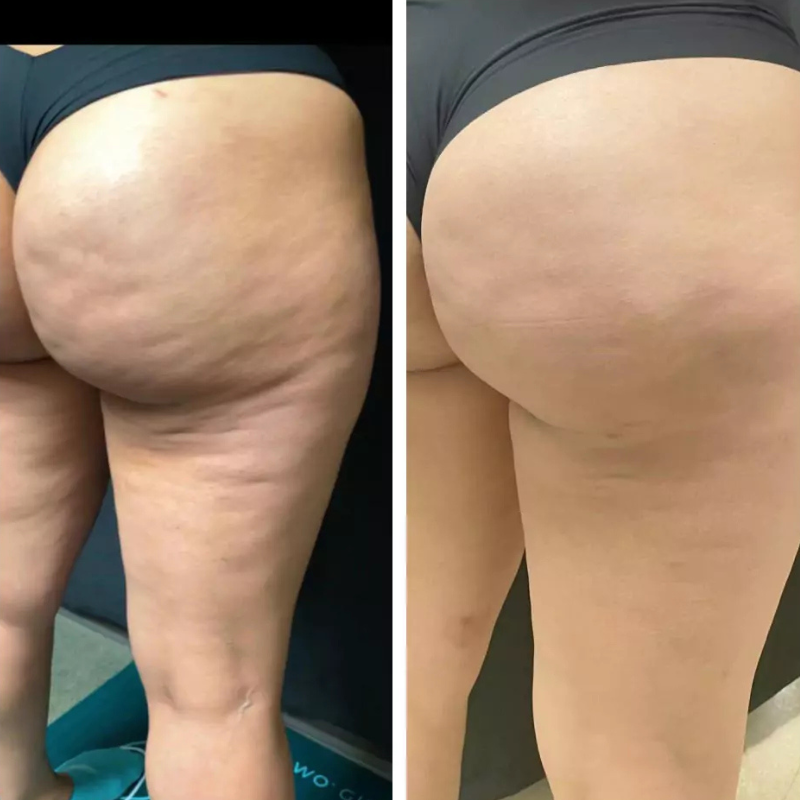 Oce Aura Anti-cellulitis Crème