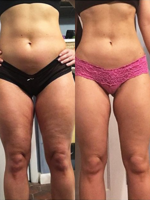 Zie de transformatie