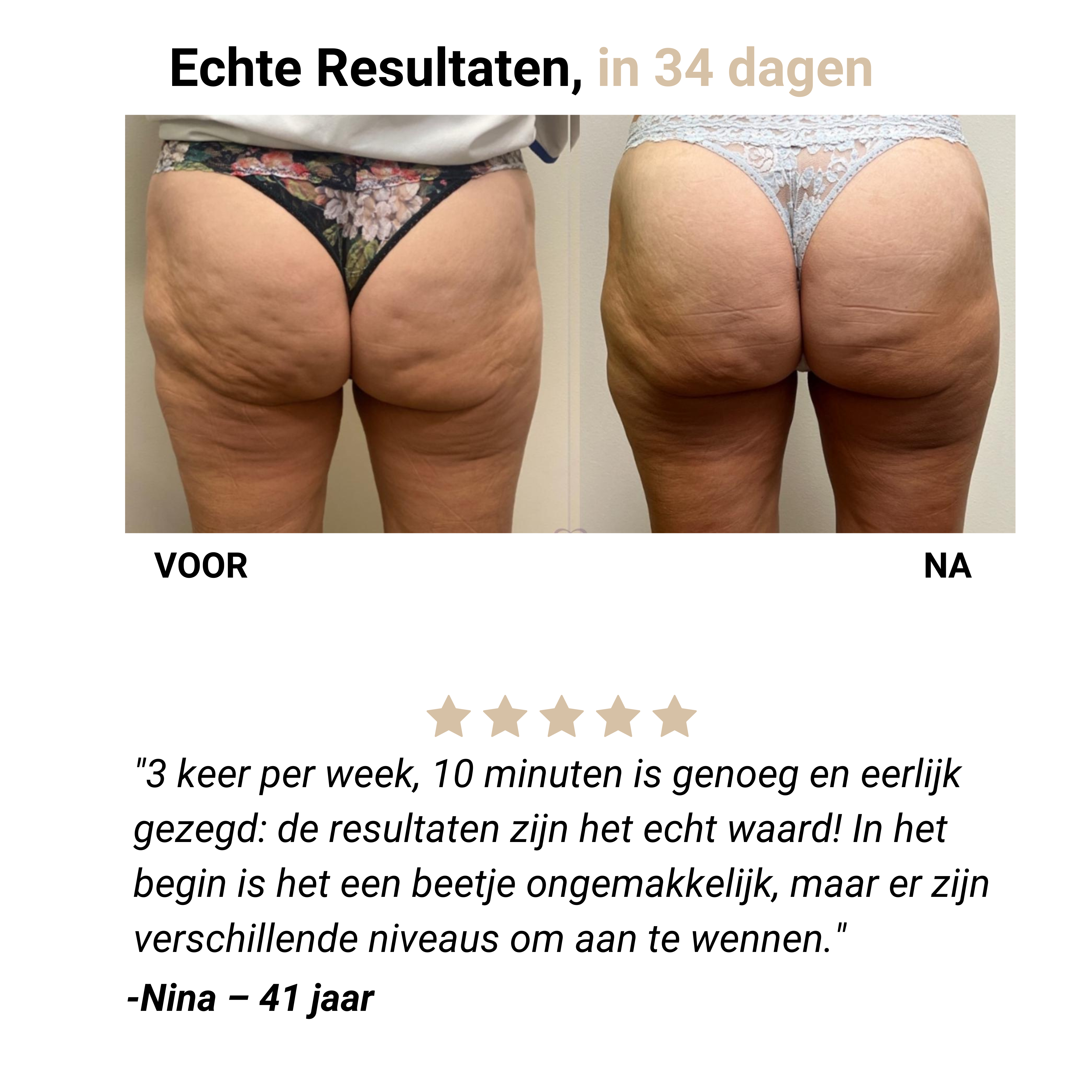 Livia Anti-Cellulitis Massageapparaat