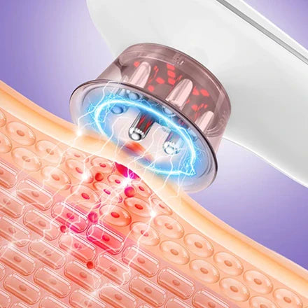 Rosa Cellulitis Massageapparaat